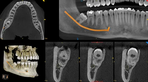 CS9600 image
