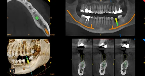CS9600 image