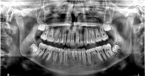 CS9600 image